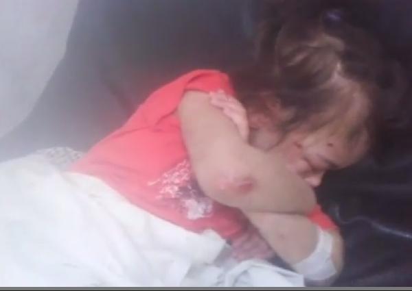 فيديو لطفلة بها أثار تعذيب أمام المستشفى الأميري بالأسكندرية