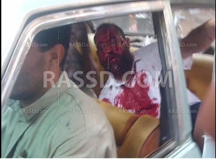 إصابة 36 شخص من رافضي الانقلاب العسكري بأبو كبير