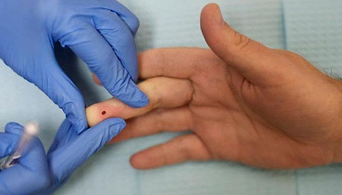 روسيا.. طريقة جديدة لتشخيص الأمراض عن طريق قطرة الدم