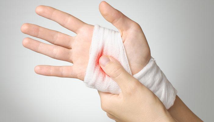 علماء أميركيون يتوصلون لمسحوق قادر على وقف النزيف فورًا