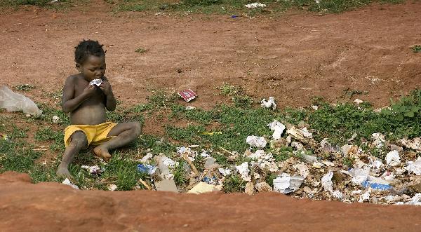 فاو: نصف سكان العالم يعانون من سوء التغذية