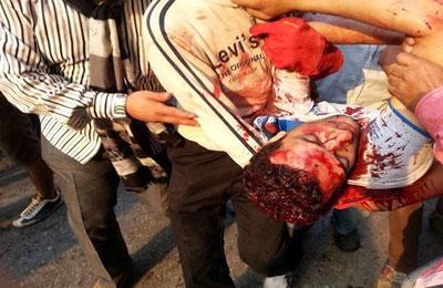 منظمة العفو الدولية تطالب بالتحقيق في مجازر 6 أكتوبر