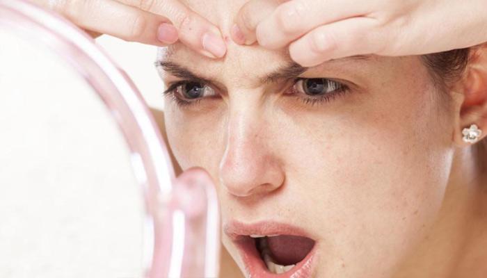 5 نصائح  للتعامل مع البشرة الدهنية بعلاجات منزلية