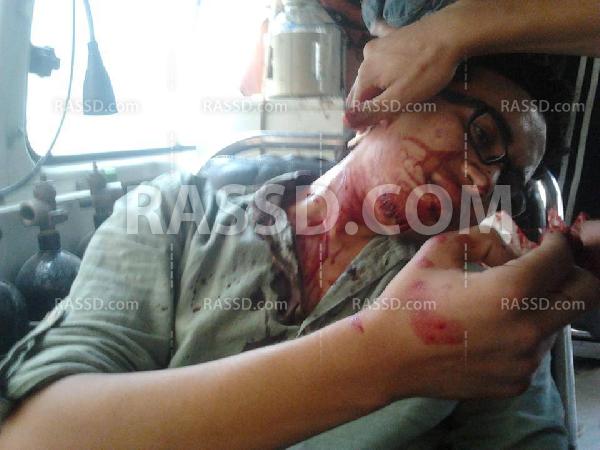 عاجل..بلطجية يعتدون على طالب أزهري بتفهمنا الأشراف