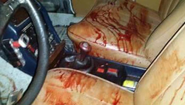 مجهولون يطلقون النار على ضابط بالشرقية