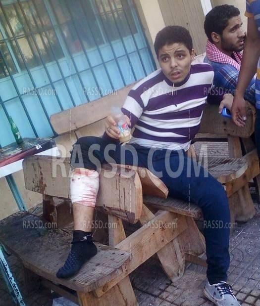 الخرطوش يصيب طلاب الازهر