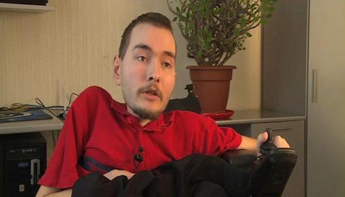 روسي يبحث عن متبرع بجسد ليزرع رأس عليه