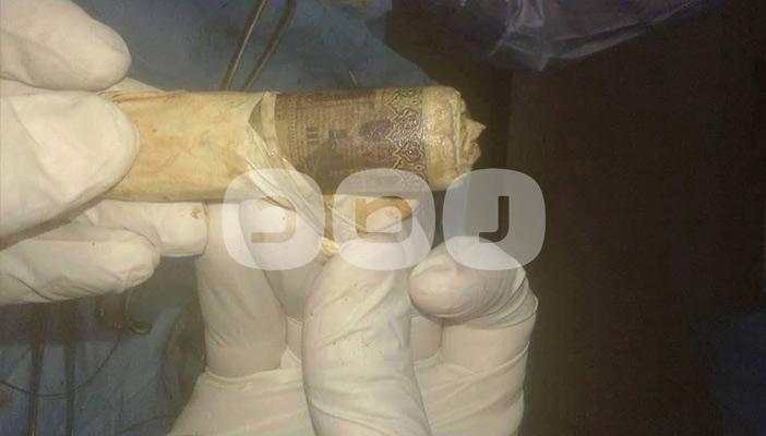 من المقص إلى الألف جنيه.. بطن المصري تبلع كل شيء