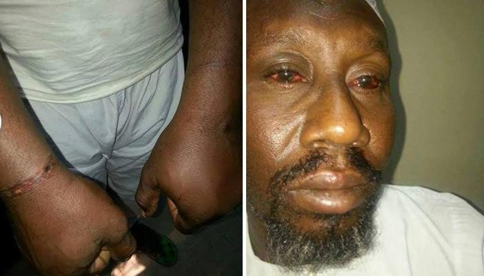 دعوات للتظاهر أمام السفارة المصرية بالسودان احتجاجا على سوء المعاملة