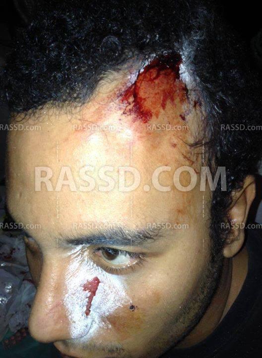 إصابات بين متظاهري بورسعيد بذكرى محمد محمود