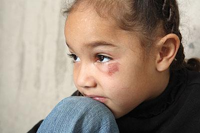 إهانة الأطفال في الصغر تضر نفسيًا عند الكبر