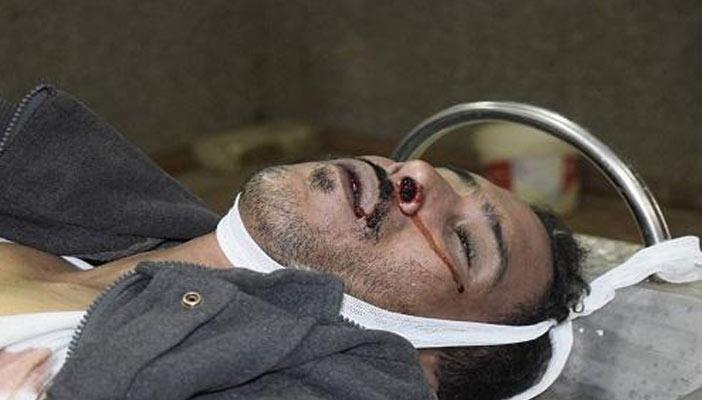 بالصور.. آثار التعذيب على جثة قتيل الشرطة بشبين القناطر