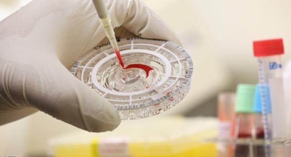 جامعة أوكسفورد تبدأ التجارب على دواء منشط للقاح الإيبولا