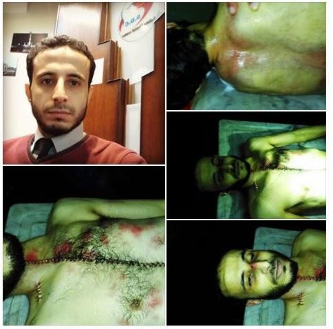 غدًا.. محاكمة قتلة المحامي كريم حمدي بقسم شرطة المطرية