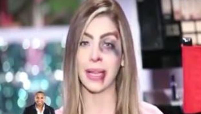 بالفيديو.. مذيعة “النهار” تظهر على الهواء بآثار ضرب على وجهها