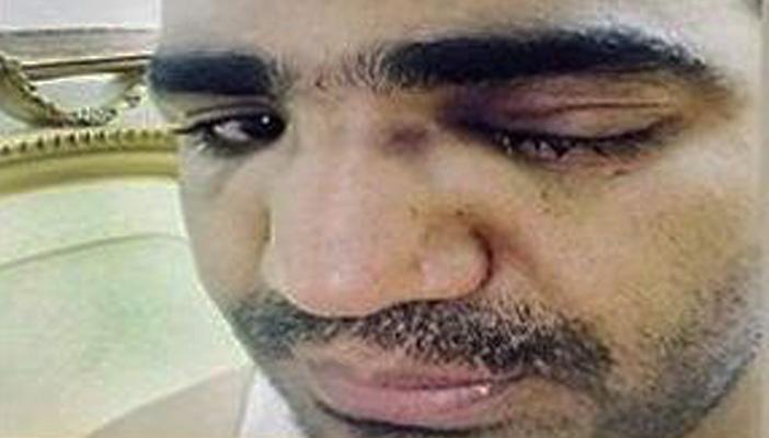 ضابط يكسر أنف مواطن طلب التأكد من هويته