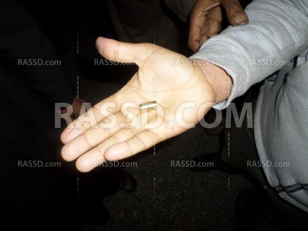 بالصور..أمين شرطة يطلق النار على مواطن بقنا ويهرب